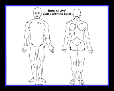 guaifenesin protocol body map guaifenesin protocol body map