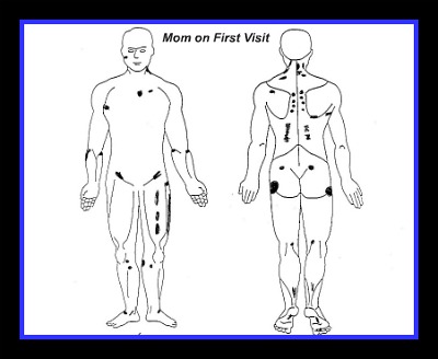 guaifenesin protocol body map guaifenesin protocol body map