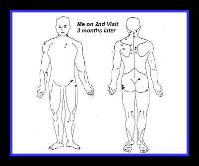 guaifenesin protocol body map 3 months later guaifenesin protocol body map 3 months later