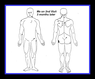 guaifenesin protocol body map 3 months later