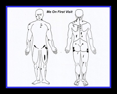 guaifenesin protocol body map