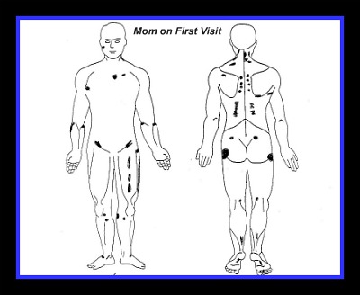 guaifenesin protocol body map